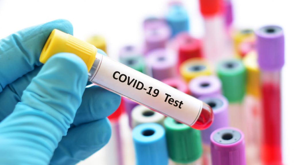 Covid-19 mass testing – the need for strategic implementation