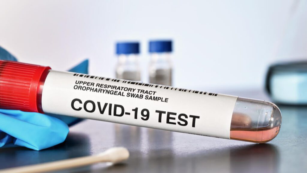 covid test results