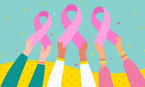 MIT announce AI predictive tool for breast cancer