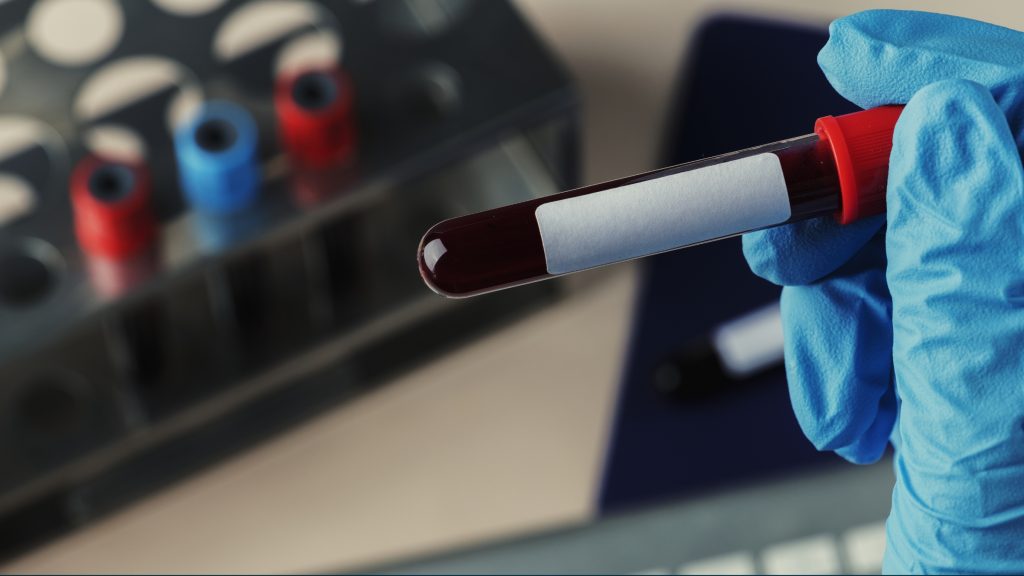 Researchers at Japan’s National Defense Medical College brought sci-fi closer to reality with a breakthrough in synthetic blood transfusion.
